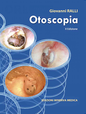 Otoscopia