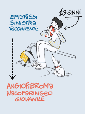 Epistassi monolaterale e ostruzione nasale in un adolescente