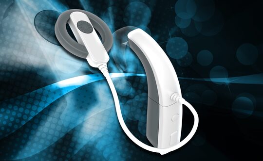 Impianto cocleare come trattamento della sordità monolaterale o dell’ipoacusia asimmetrica: analisi costo-beneficio