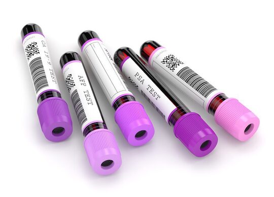 Prevedere la prognosi nei tumori testa-collo: l’importanza dei marker infiammatori 