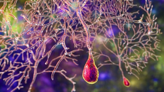 Flocculo e paraflocculo cerebellari: possibile ruolo nella modulazione dell’acufene