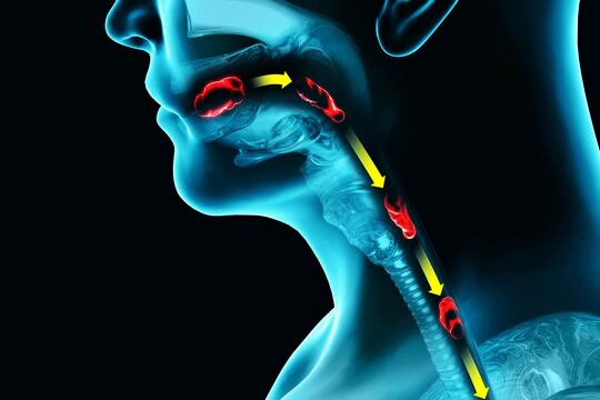 Disfagia: cause, trattamenti e indicazioni sull'alimentazione