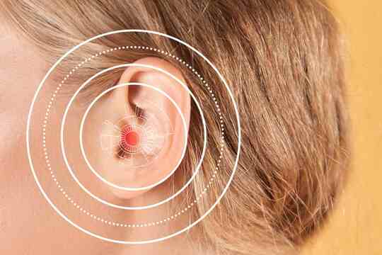 Acceptable Noise Level (ANL): nuove prospettive sull'ANL e gli apparecchi acustici