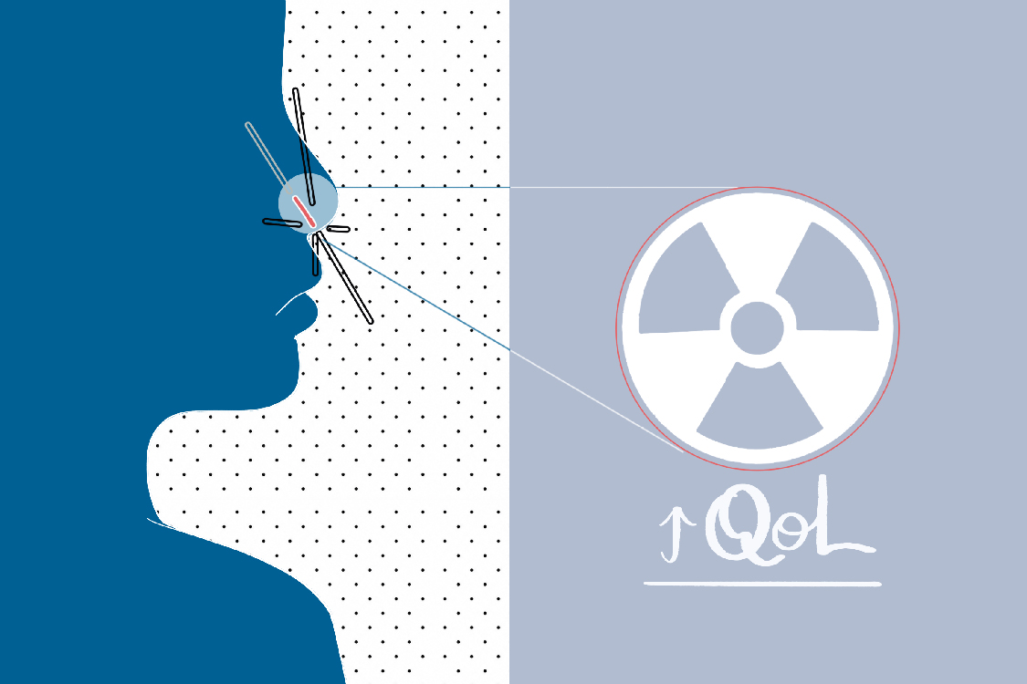 Il carcinoma del vestibolo nasale: da malattia sottostimata a nuovo paradigma di classificazione e preservazione d’organo