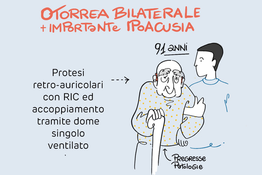OCM e ipoacusia mista grave-profonda